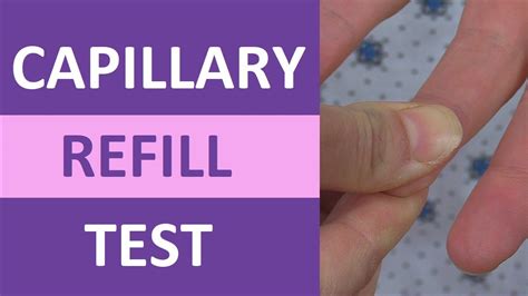 testing capillary refill on thick and yellow nail|how to chart cap refill.